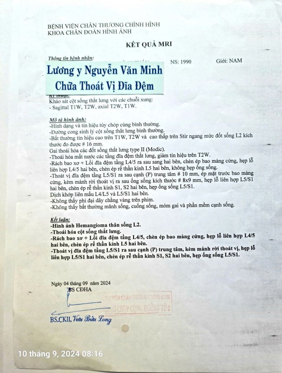 thoat-vi-dia-dem-chen-day-than-kinh